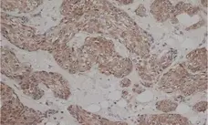 Anti Human Estrogen Receptor Beta 1 Antibody, clone PPG5/10 gallery image 3