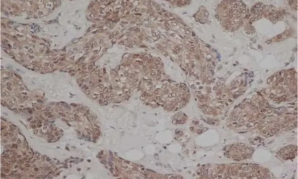 Anti Human Estrogen Receptor Beta 1 Antibody, clone PPG5/10 gallery image 3