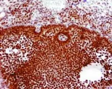Anti Human Estrogen Receptor Beta 1 Antibody, clone PPG5/10 gallery image 4