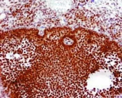 Anti Human Estrogen Receptor Beta 1 Antibody, clone PPG5/10 gallery image 4