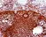 Anti Human Estrogen Receptor Beta 1 Antibody, clone PPG5/10 thumbnail image 4
