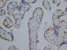 Anti Human Estrogen Receptor Beta 1 Antibody, clone PPG5/10 gallery image 5