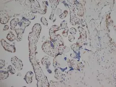 Anti Human Estrogen Receptor Beta 1 Antibody, clone PPG5/10 gallery image 6