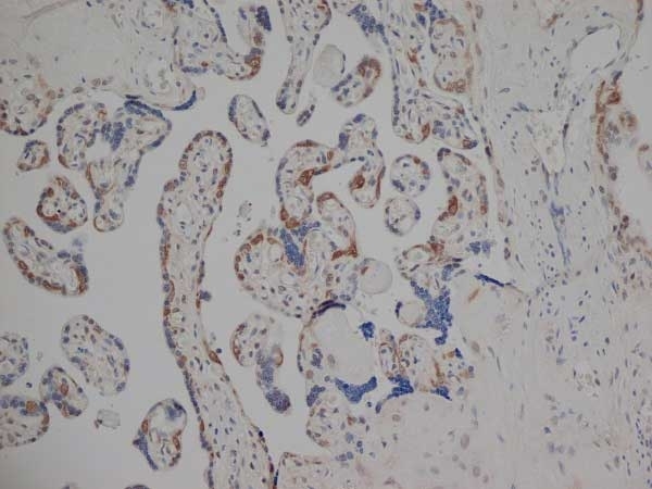 Anti Human Estrogen Receptor Beta 1 Antibody, clone PPG5/10 gallery image 6