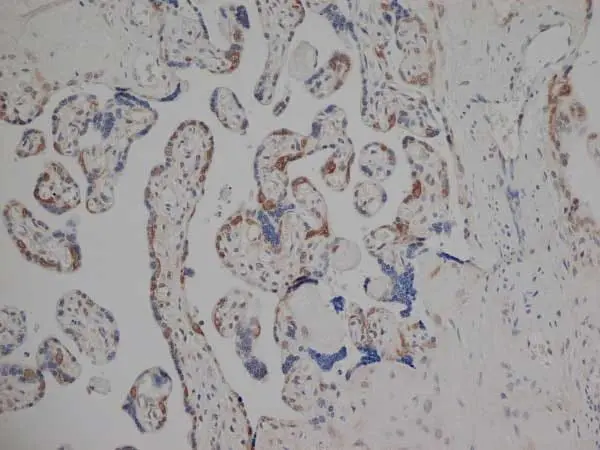Anti Human Estrogen Receptor Beta 1 Antibody, clone PPG5/10 gallery image 6