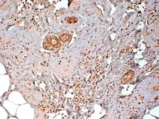 Anti Human Estrogen Receptor Beta 1 Antibody, clone PPG5/10 gallery image 7