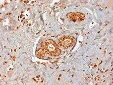 Anti Human Estrogen Receptor Beta 1 Antibody, clone PPG5/10 gallery image 8