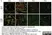 Anti Human Estrogen Receptor Beta 1 Antibody, clone PPG5/10 thumbnail image 9