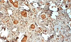 Anti Human Estrogen Receptor Beta 2 Antibody, clone 57/3 gallery image 1