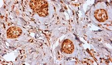 Anti Human Estrogen Receptor Beta 2 Antibody, clone 57/3 gallery image 2