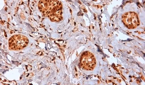 Anti Human Estrogen Receptor Beta 2 Antibody, clone 57/3 gallery image 2