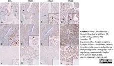 Anti Human Estrogen Receptor Beta 2 Antibody, clone 57/3 gallery image 3