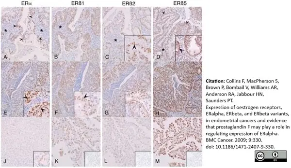 Anti Human Estrogen Receptor Beta 2 Antibody, clone 57/3 gallery image 3