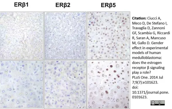 Anti Human Estrogen Receptor Beta 2 Antibody, clone 57/3 gallery image 5