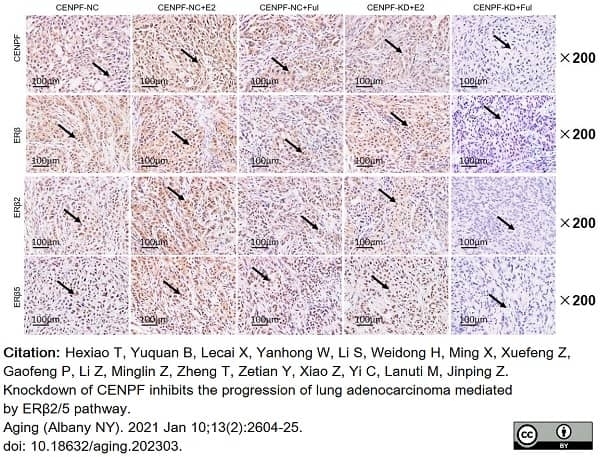 Anti Human Estrogen Receptor Beta 2 Antibody, clone 57/3 gallery image 7