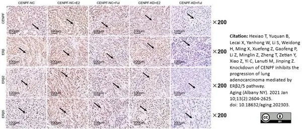 Anti Human Estrogen Receptor Beta 2 Antibody, clone 57/3 gallery image 7