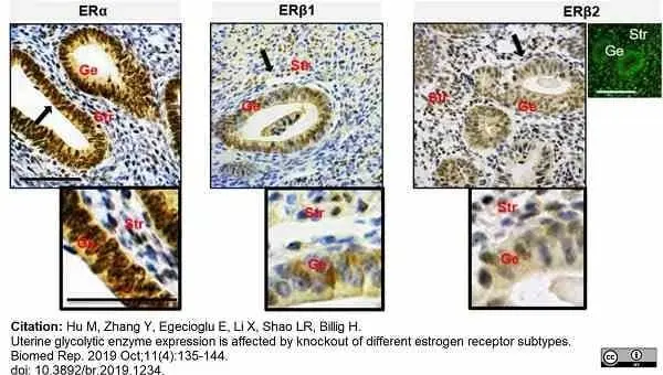 Anti Human Estrogen Receptor Beta 2 Antibody, clone 57/3 gallery image 8