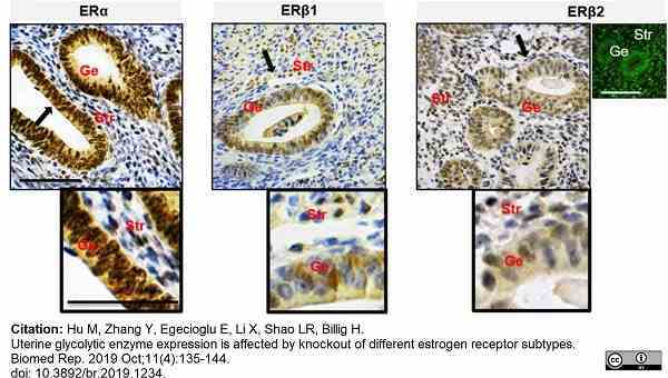 Anti Human Estrogen Receptor Beta 2 Antibody, clone 57/3 gallery image 9