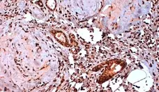 Anti Human Estrogen Receptor Beta 5 Antibody, clone 5/25 gallery image 1