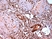 Anti Human Estrogen Receptor Beta 5 Antibody, clone 5/25 thumbnail image 1