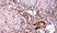 Anti Human Estrogen Receptor Beta 5 Antibody, clone 5/25 thumbnail image 1