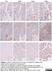 Anti Human Estrogen Receptor Beta 5 Antibody, clone 5/25 thumbnail image 3