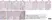 Anti Human Estrogen Receptor Beta 5 Antibody, clone 5/25 thumbnail image 3
