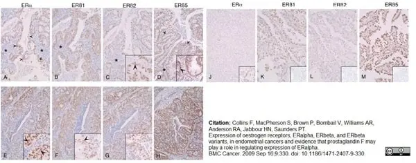 Anti Human Estrogen Receptor Beta 5 Antibody, clone 5/25 gallery image 3