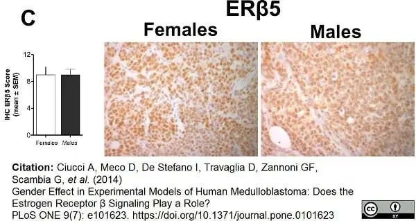 Anti Human Estrogen Receptor Beta 5 Antibody, clone 5/25 gallery image 5