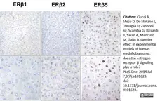Anti Human Estrogen Receptor Beta 5 Antibody, clone 5/25 gallery image 6