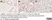 Anti Human Estrogen Receptor Beta 5 Antibody, clone 5/25 thumbnail image 7