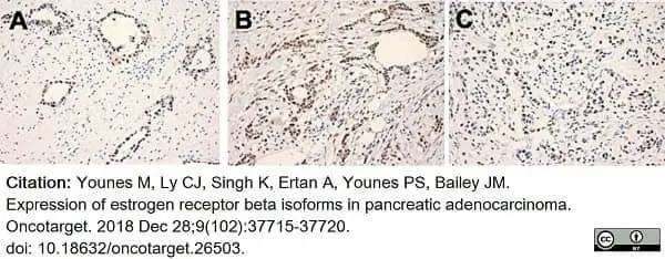 Anti Human Estrogen Receptor Beta 5 Antibody, clone 5/25 gallery image 7