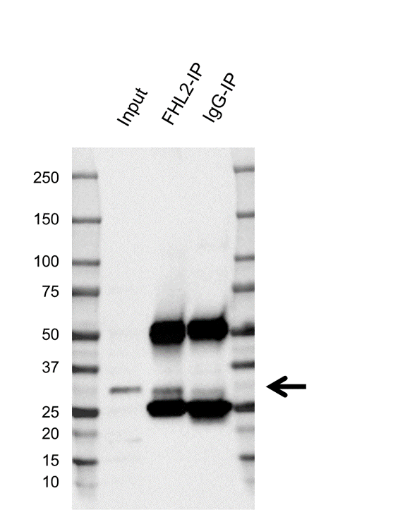 Anti FHL2 Antibody, clone AB04-4H8 (PrecisionAb Monoclonal Antibody) gallery image 2