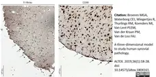 Anti Human Fibroblasts/Epithelial Cells Antibody, clone D7-FIB gallery image 2