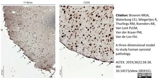 Anti Human Fibroblasts/Epithelial Cells Antibody, clone D7-FIB gallery image 2