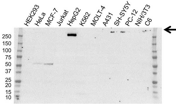 Anti Fibronectin Antibody (PrecisionAb Monoclonal Antibody) gallery image 1