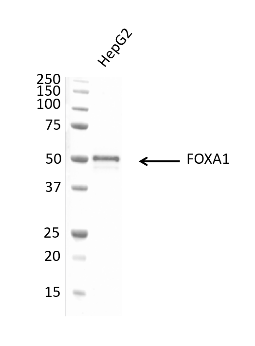 Anti FOXA1 Antibody, clone FOXA1/1512 (PrecisionAb Monoclonal Antibody) gallery image 2
