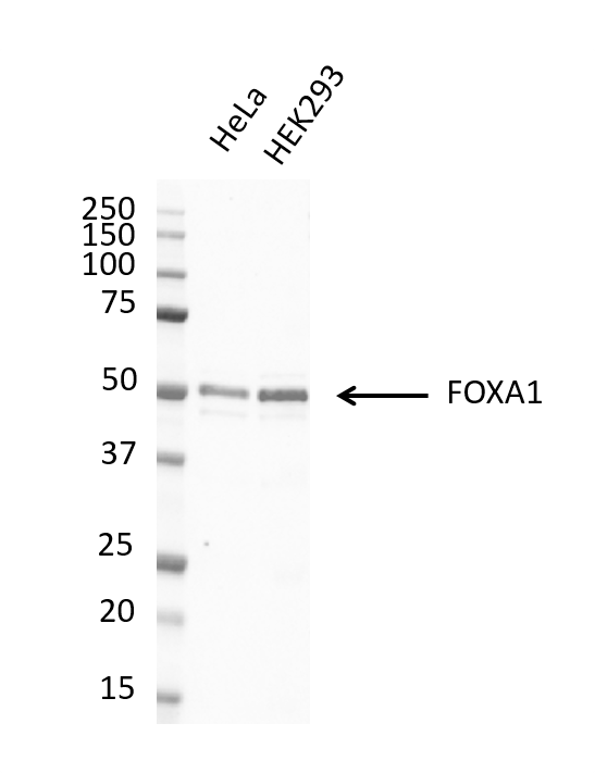 Anti FOXA1 Antibody, clone FOXA1/1512 (PrecisionAb Monoclonal Antibody) gallery image 3