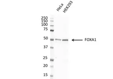 Anti FOXA1 Antibody, clone FOXA1/1512 (PrecisionAb Monoclonal Antibody) gallery image 4