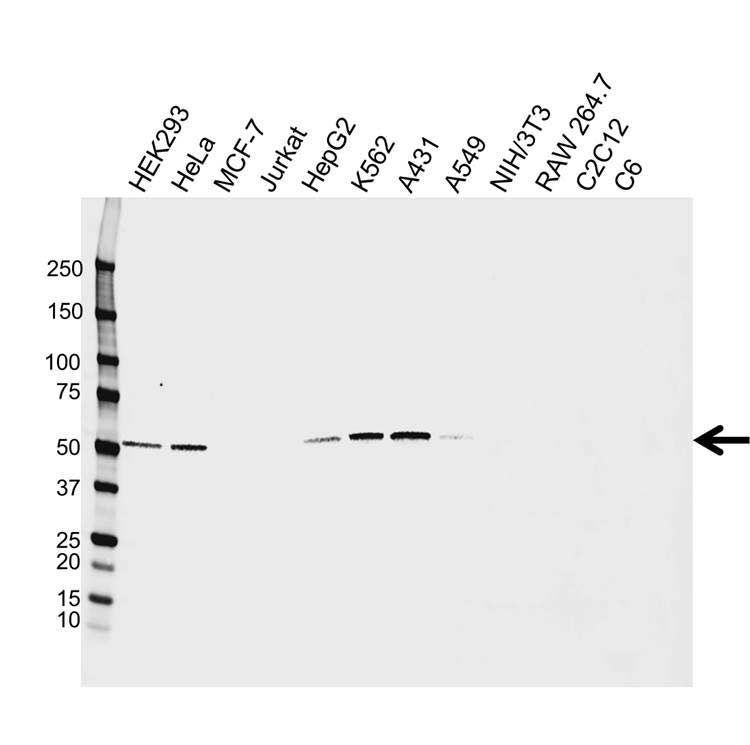 Anti FSCN1 Antibody, clone CPTC29 (PrecisionAb Monoclonal Antibody) gallery image 1