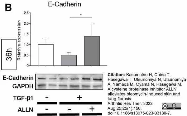 ANTI-GAPDH hFAB™ Rhodamine Antibody Antibody, clone AbD22549 gallery image 3