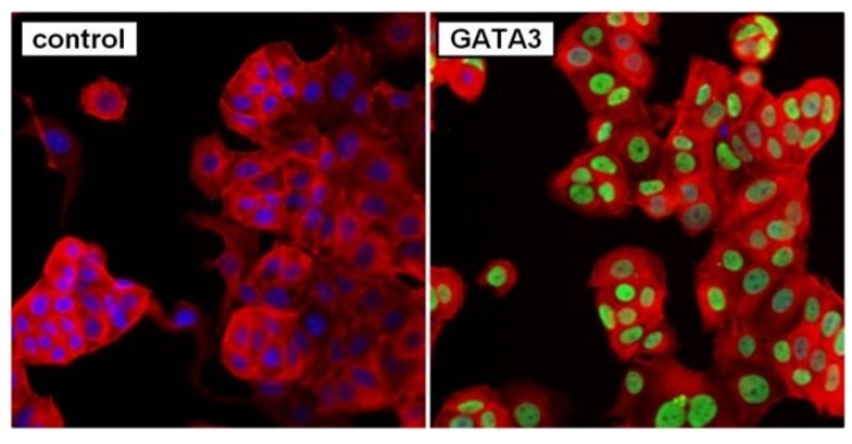 Anti GATA3 Antibody, clone 1A12-1D9 gallery image 2