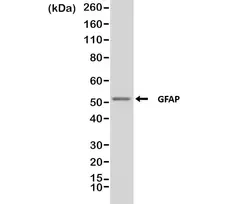 Anti GFAP Antibody, clone RM246 gallery image 1