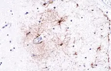 Anti GFAP Antibody, clone RM246 gallery image 2