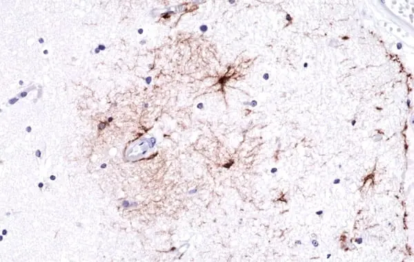 Anti GFAP Antibody, clone RM246 gallery image 2