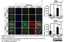 Anti GFAP Antibody, clone RM246 gallery image 3