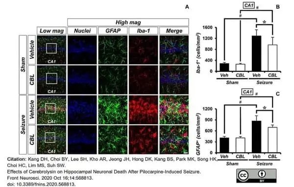 Anti GFAP Antibody, clone RM246 gallery image 3