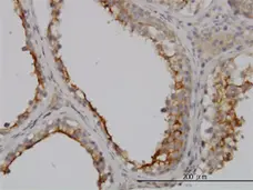 Anti Human GGT1 Antibody, clone 1F9 gallery image 2