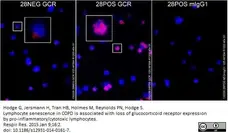 Anti Human Glucocorticoid Receptor Antibody, clone 5E4 gallery image 2