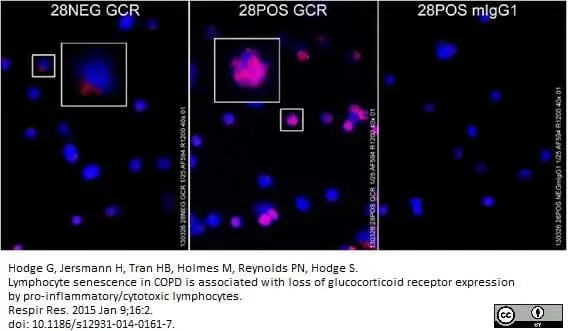 Anti Human Glucocorticoid Receptor Antibody, clone 5E4 gallery image 2